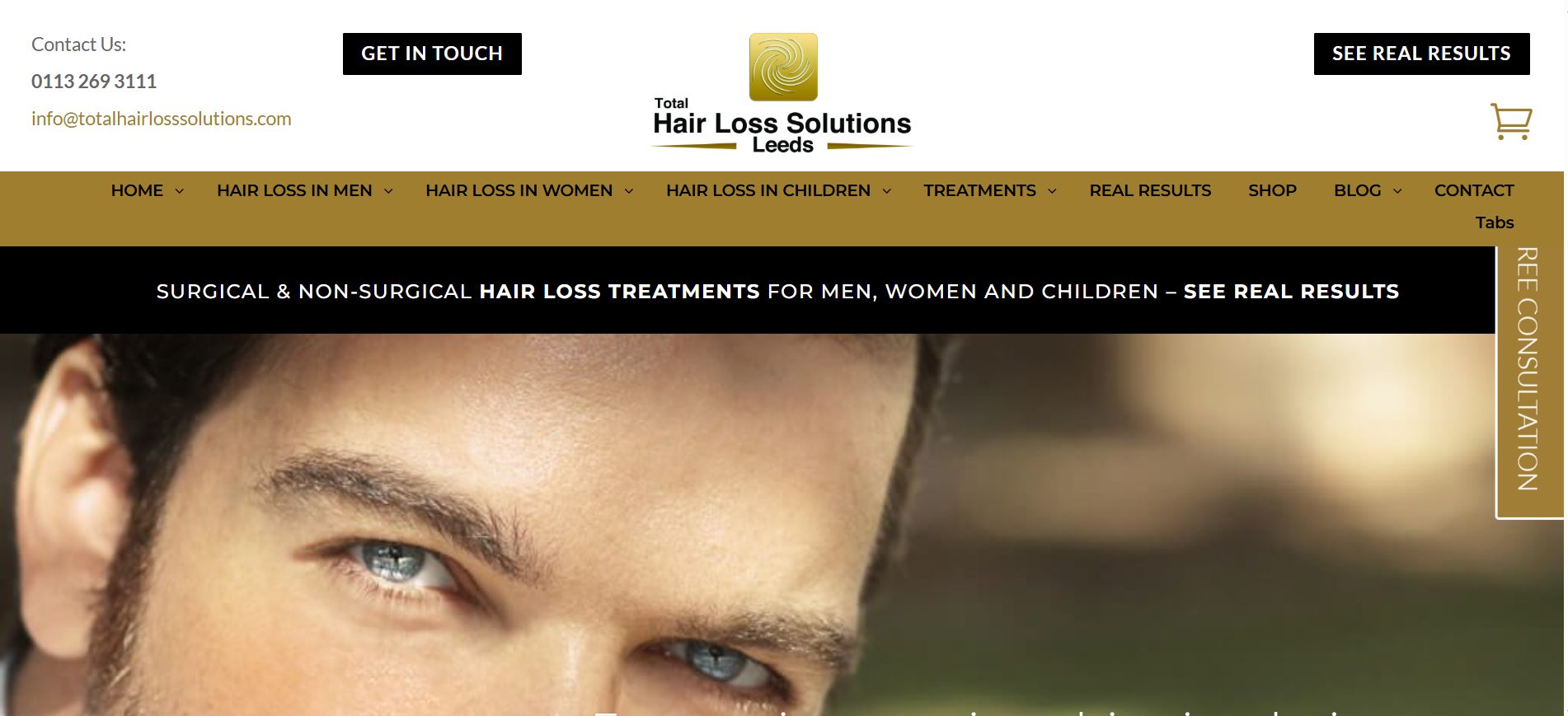 Hair loss treatment for men near me