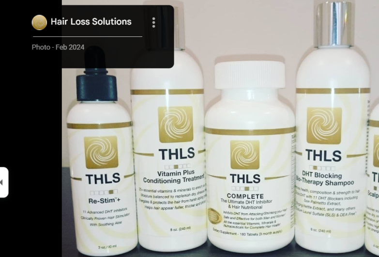 hair loss treatment for men in yorkshire