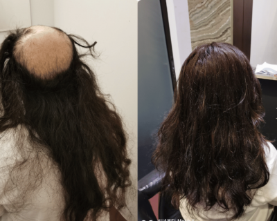 hairspec